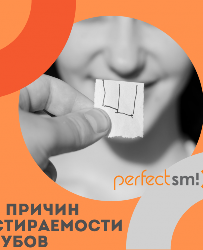 5 причин стираемости зубов